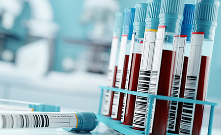 Test tubes filled with blood in a lab.